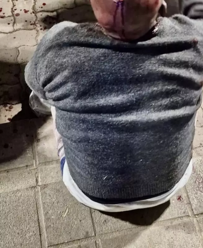 ATM Scammer Beaten by Mob in South Africa Shopping Centre