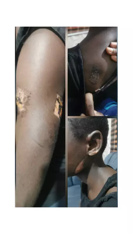 Guardian Arrested in Rivers for Torturing Teen with Hot Knife