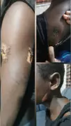 Guardian Arrested in Rivers for Torturing Teen with Hot Knife