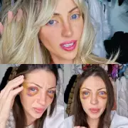 Human Barbie Influencer D!es After 27 Surgeries to Transform Into Living Doll