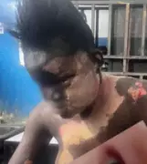 Kano Hotel Worker Suffers Severe Burns in Boiling Water Attack