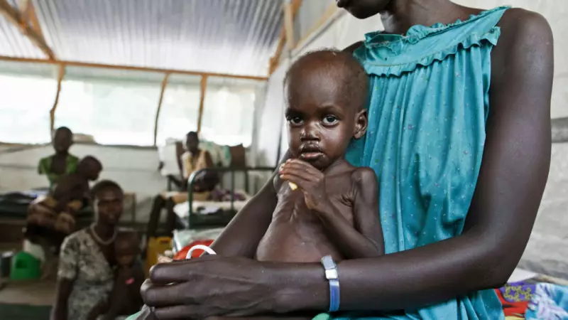 5.4M Nigerian Children Malnourished as Poverty, Insecurity Fuel Crisis
