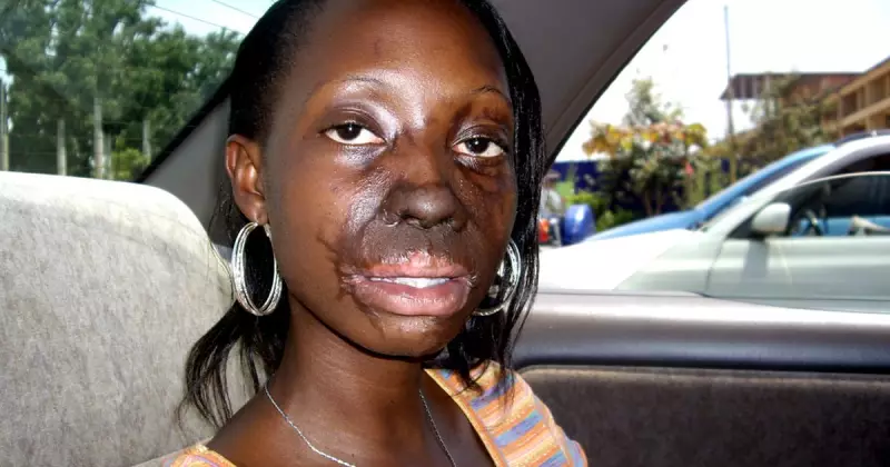 Acid Attack Survival Guide: Critical First Aid Steps and Safety Tips