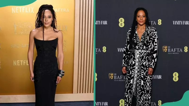 Rosalind Eleazar's Viral Fingers: The Truth About Her Condition & Career