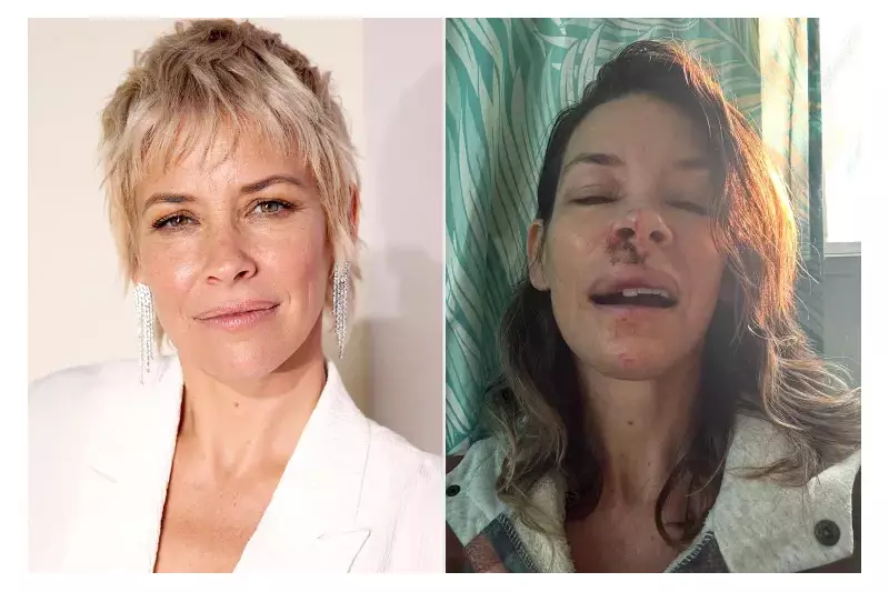 Evangeline Lilly Reveals Brain Damage After 2025 Beach Accident