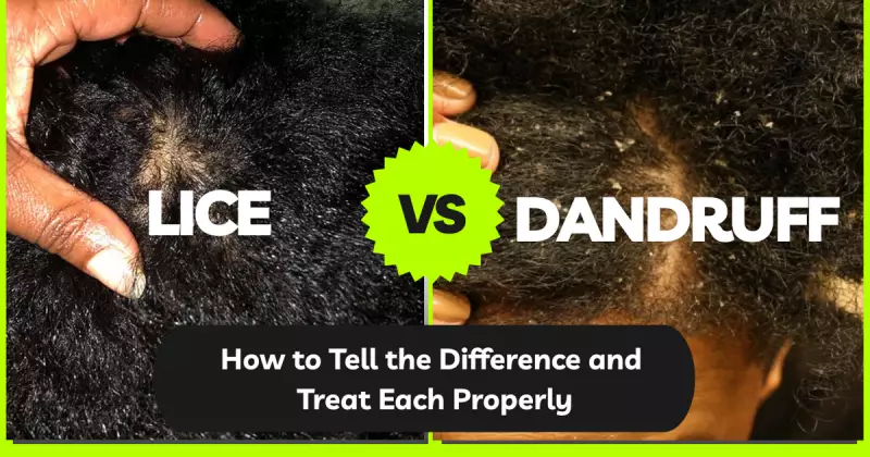 Lice vs Dandruff in Nigeria: Spot the Difference and Get the Right Treatment