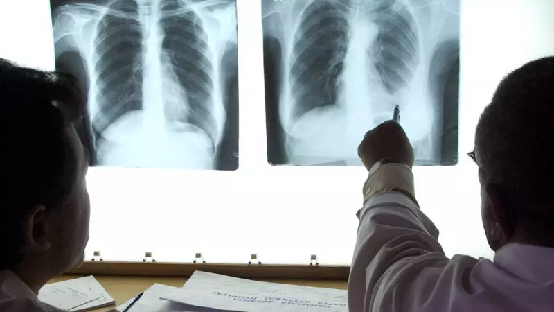 NCoS Denies TB Outbreak in Prisons, Calls Report 'Malicious'