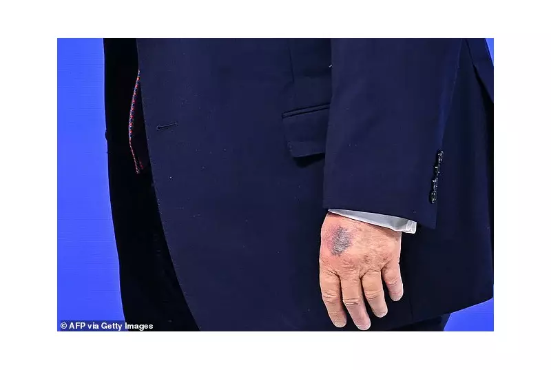 Trump's Hand Bruise at Davos Sparks Health Dialogue on Aspirin Use