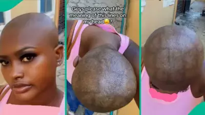 Nigerian Lady Alarmed by Mysterious Lines on Scalp After Shaving Head Bald