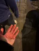 Chelsea Fans Stabbed in Naples by Ultras Before Champions League Match