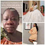 Nigerian Woman Shows How Pregnancy Changed Her Face: Grey Hair & Wider Nose