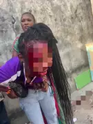 Stepfather Detained After Allegedly Attacking Girl with Nail-Studded Plank in Lagos