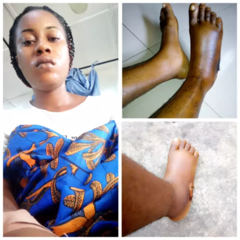 Nigerian Woman Recounts Terrifying Snake Bite Experience in Lokoja