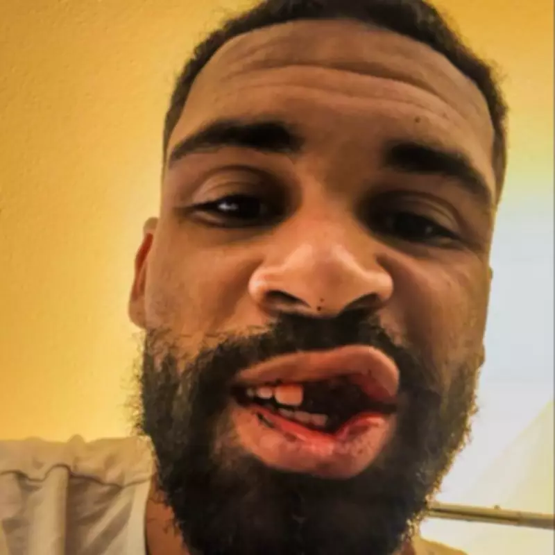 Ruben Loftus-Cheek Suffers Broken Jaw and Loses Teeth in AC Milan Collision