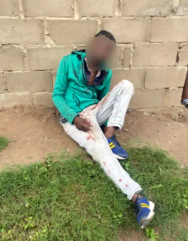 South African Man Hospitalized After Girlfriend's Alcohol-Fueled Bottle Attack