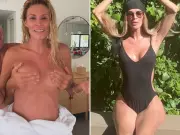 Brandi Glanville Warns: Breast Implants Caused Facial Parasite Infection