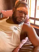 DJ Hospitalized After Alleged Assault by Bride's Family at Benue Wedding Over Payment Dispute