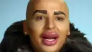 Kim Kardashian Lookalike, 'Britain's Lip King', Dies at 31