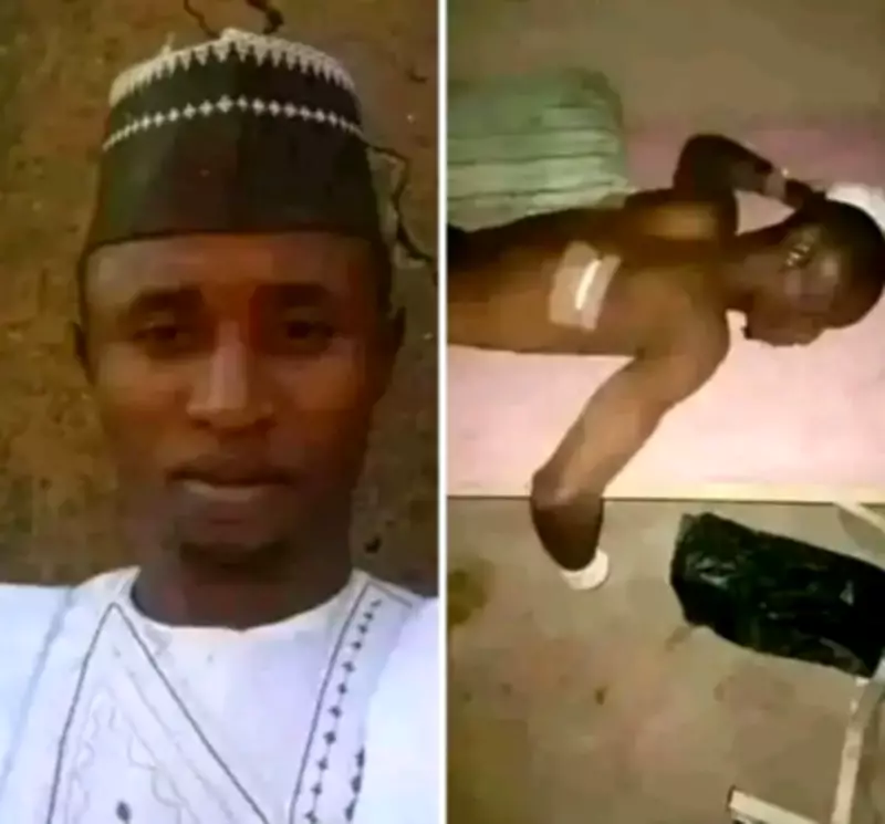 Kaduna Farmer's Hand Amputated by Bandits in Brutal Farm Attack