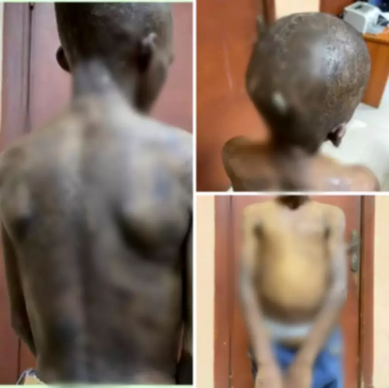 Lagos State Government Rescues 11-Year-Old Boy Tortured by Biological Mother