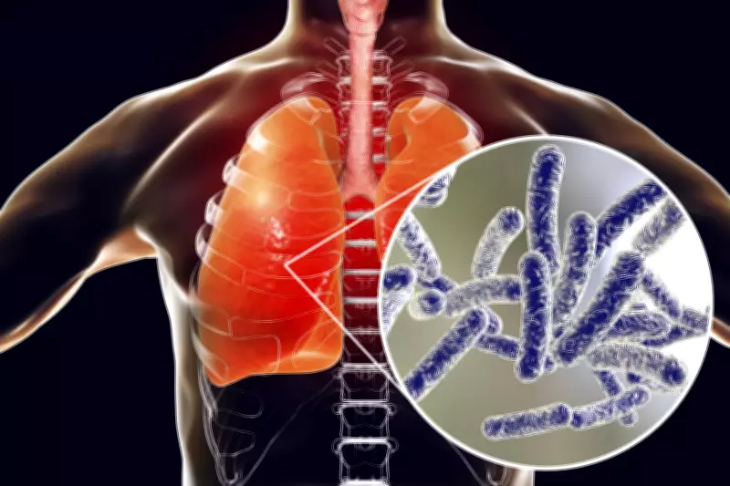 Legionnaires' Disease Outbreak Detected in Two London Areas, Health Probe Launched