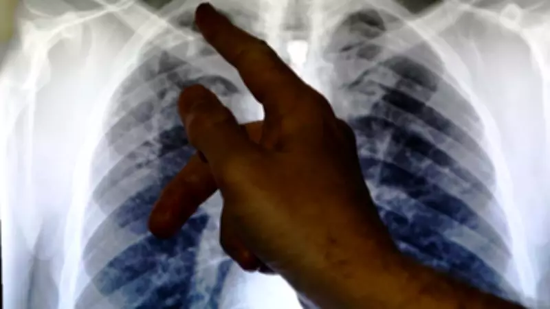 Nigeria's TB Control Gains Threatened by Funding Gaps, Stigma, and Malnutrition