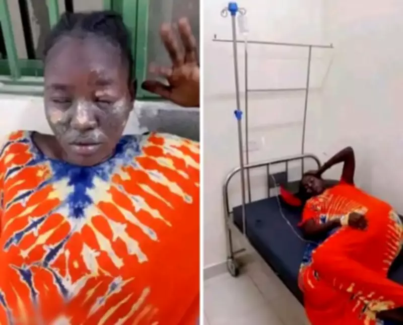 Second Wife Arrested for Allegedly Scalding First Wife in Juba Domestic Dispute