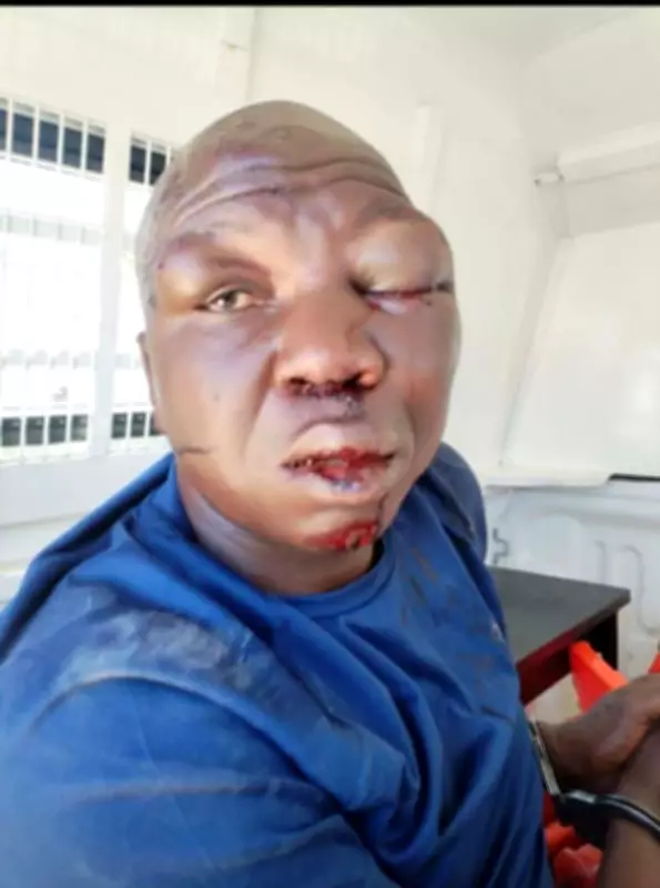 Suspected Car Hijacker Brutalized by Angry Mob in South Africa