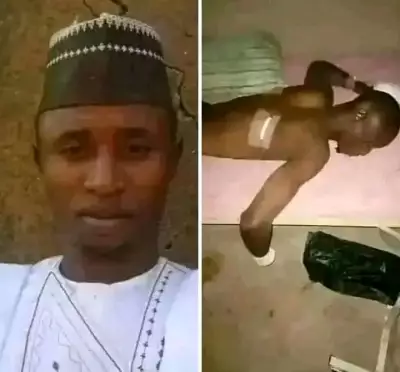 Kaduna Farmer's Hand Amputated by Bandits in Brutal Farm Attack