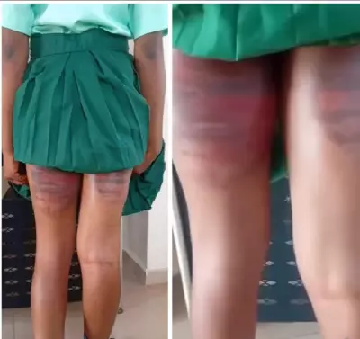 Outrage Over Alleged Brutal Beating of SS3 Student at Command Secondary School