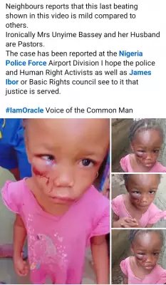 Pastor's Wife in Calabar Accused of Brutalizing Her Brother's Minor Daughter