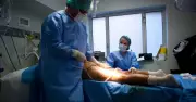 Brazilian Butt Lift (BBL) Deemed Most Dangerous Cosmetic Surgery Globally