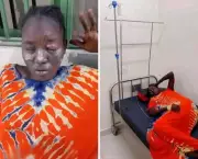 Second Wife Arrested for Allegedly Scalding First Wife in Juba Domestic Dispute