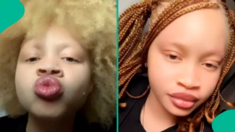 Albinism Lady's UTME 2026 Result Goes Viral After Exam