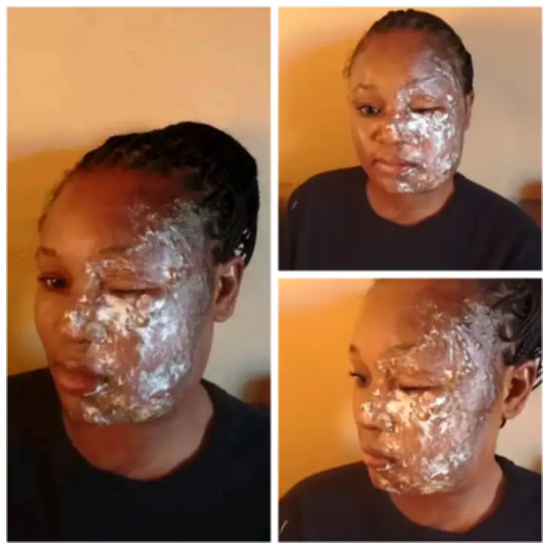 Man Arrested for Pouring Hot Cooking Oil on Wife in Lundazi Domestic Violence Case