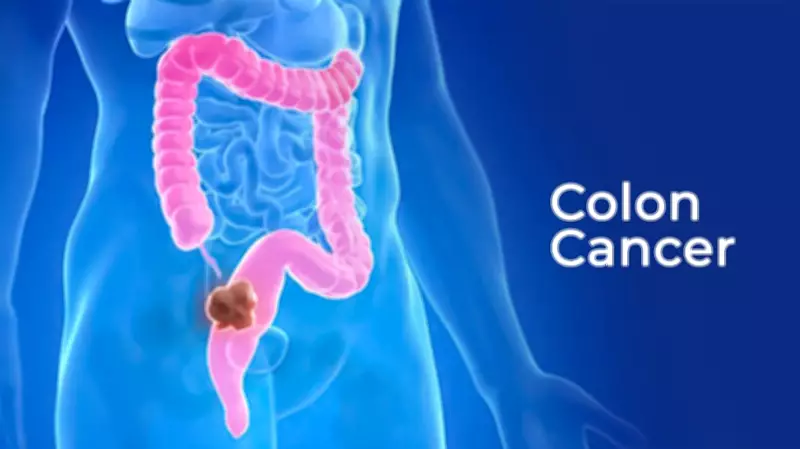 Nigerian Foundation Urges Heightened Awareness to Combat Colorectal Cancer Crisis