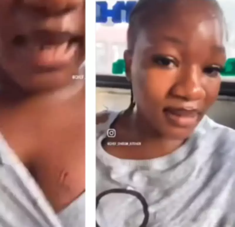 Nigerian Woman Displays Bite Mark After Bus Attack in Lagos