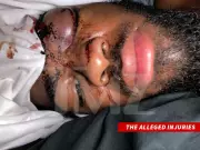 Blac Chyna Countersues Ex-Boyfriend for $20M Over Alleged Abuse and NDA Breach