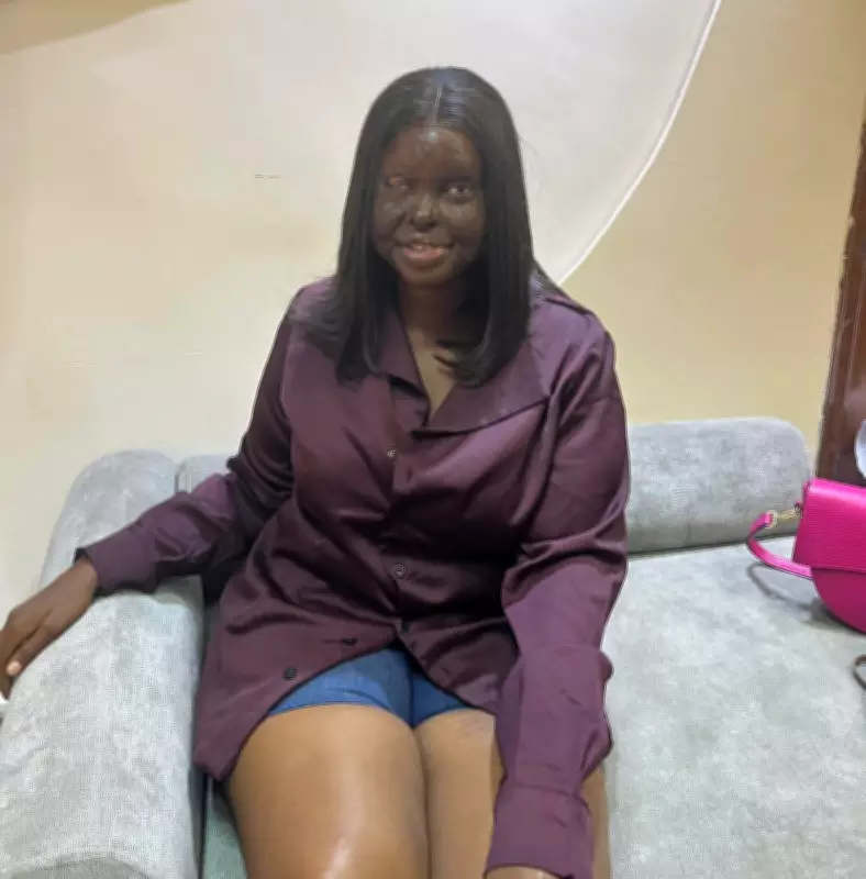 Nigerian Acid Attack Survivor Seeks Prayerful, Honest Partner