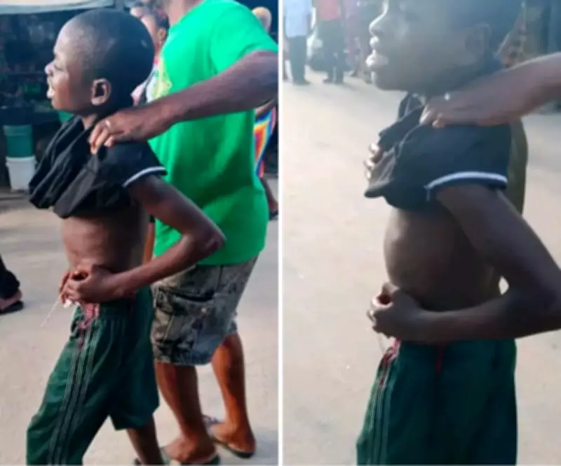Stray bullet hits boy during NDLEA drug raid in Cross River