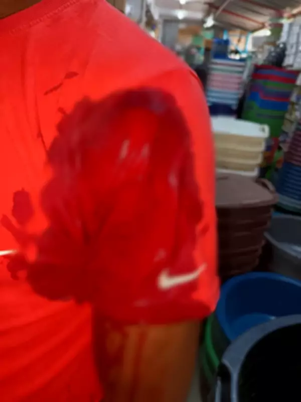 Woman Stabs Boyfriend at Work After He Refuses to Give Her Money