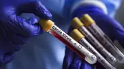 Italy Reports Two Suspected Ebola Cases After Uganda Trip
