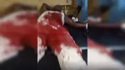 Lagos Man Seeks Justice After Neighbour's Machete Attack