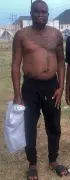 Nigerian Man Pours Acid on His Elder Brother in Shocking Attack