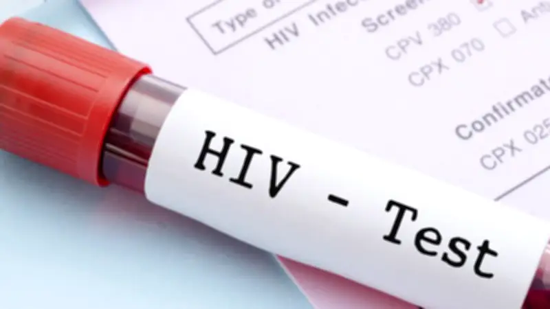 Institute Urges Youth Inclusion in HIV Prevention Strategies