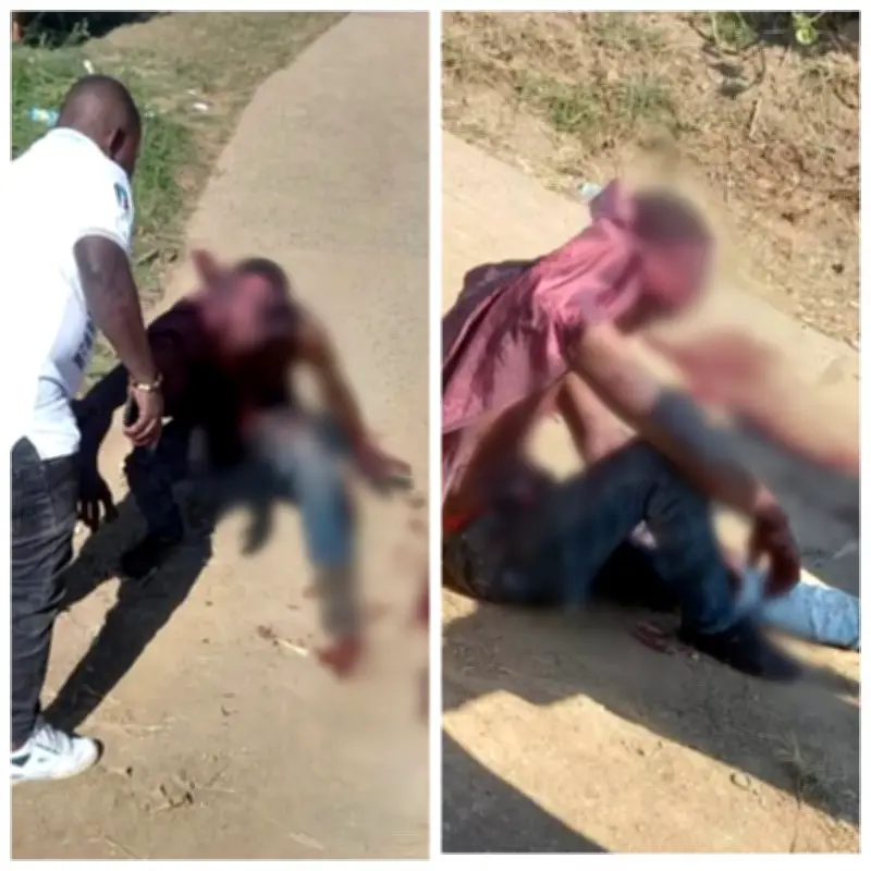 Man Critically Injured by Girlfriend in Domestic Dispute in South Africa