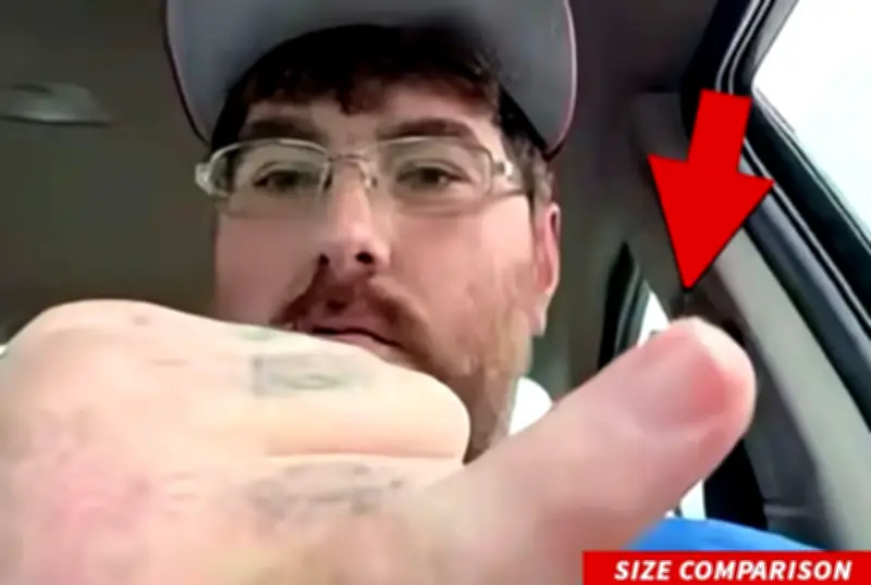 Man with world's smallest penis launches fundraising for enlargement surgery