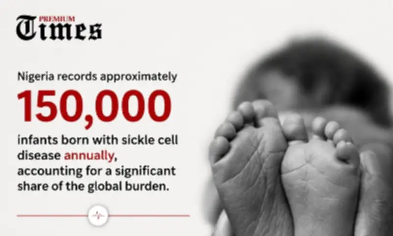 Nigeria's Sickle Cell Burden: 150,000 Newborns Yearly Amid Gaps in Care