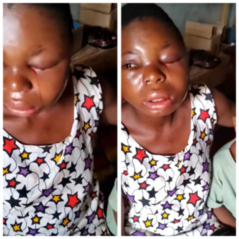Pregnant Woman Brutally Assaulted by Husband in Anambra State