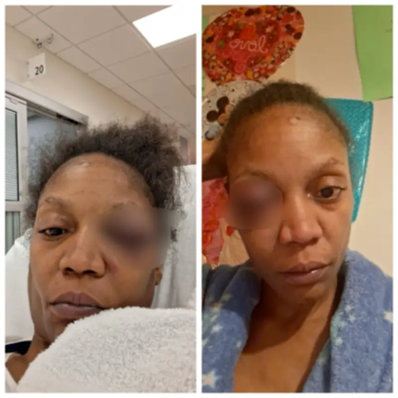 Woman accuses husband of fracturing her face in domestic assault